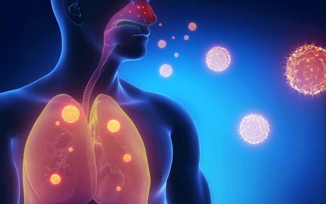 Chronic Obstructive Pulmonary Disease