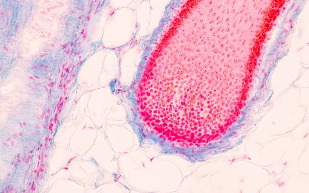 Stem Cells Could Be The Future of Hair Regrowth