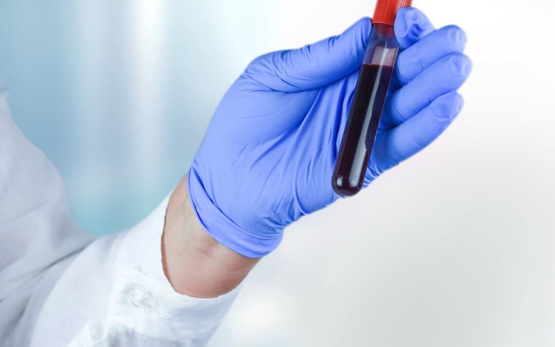 Toddler’s Rare Leukemia Treated by Sister’s Cord Blood